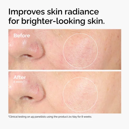 The Ordinary Alpha Arbutin 2% + HA 30ml - Image 3